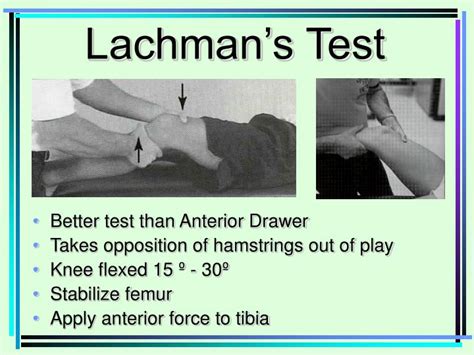 lachman's test vs anterior drawer